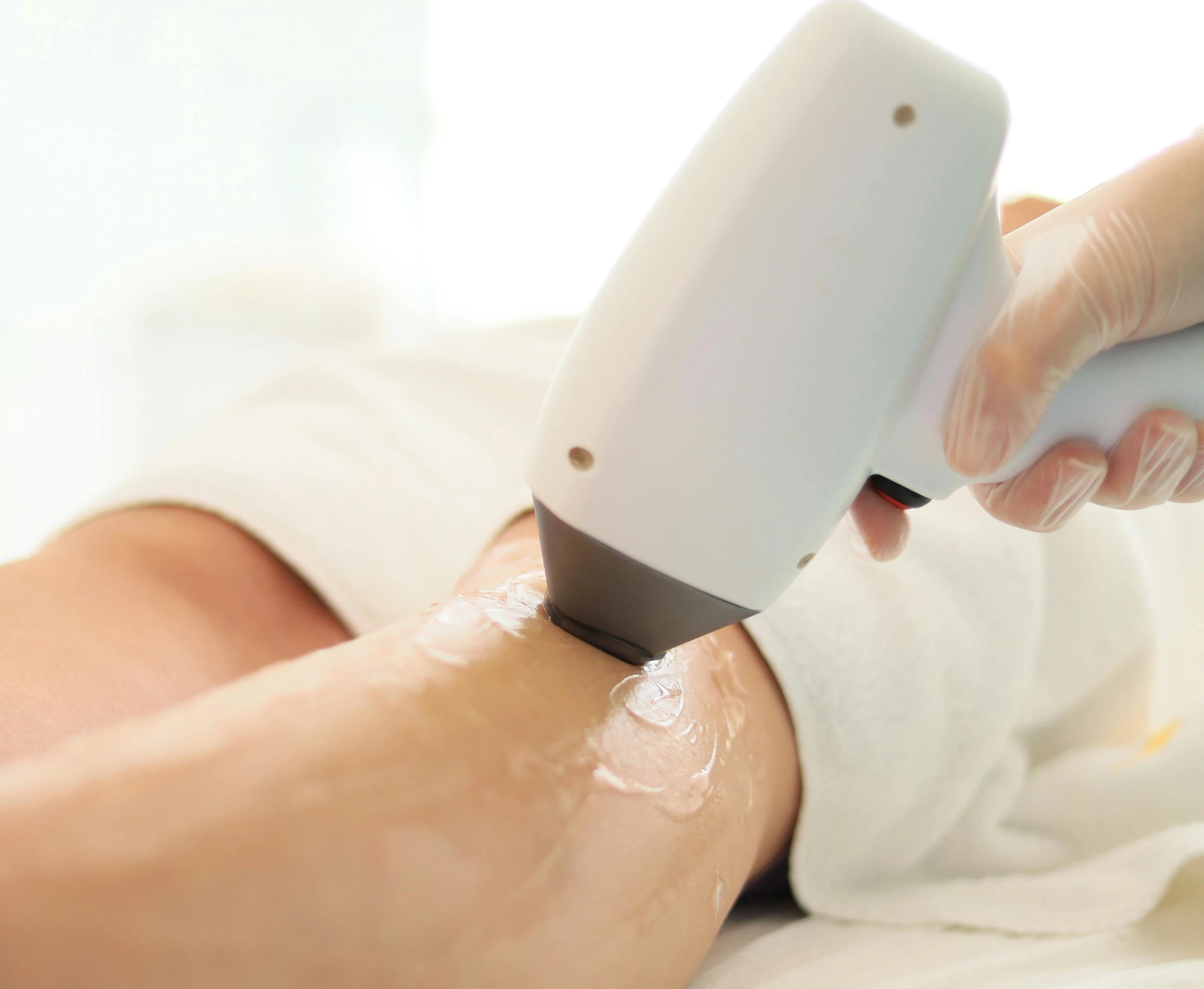 How Long Does Laser Hair Removal Take? A Complete Timeline Guide
