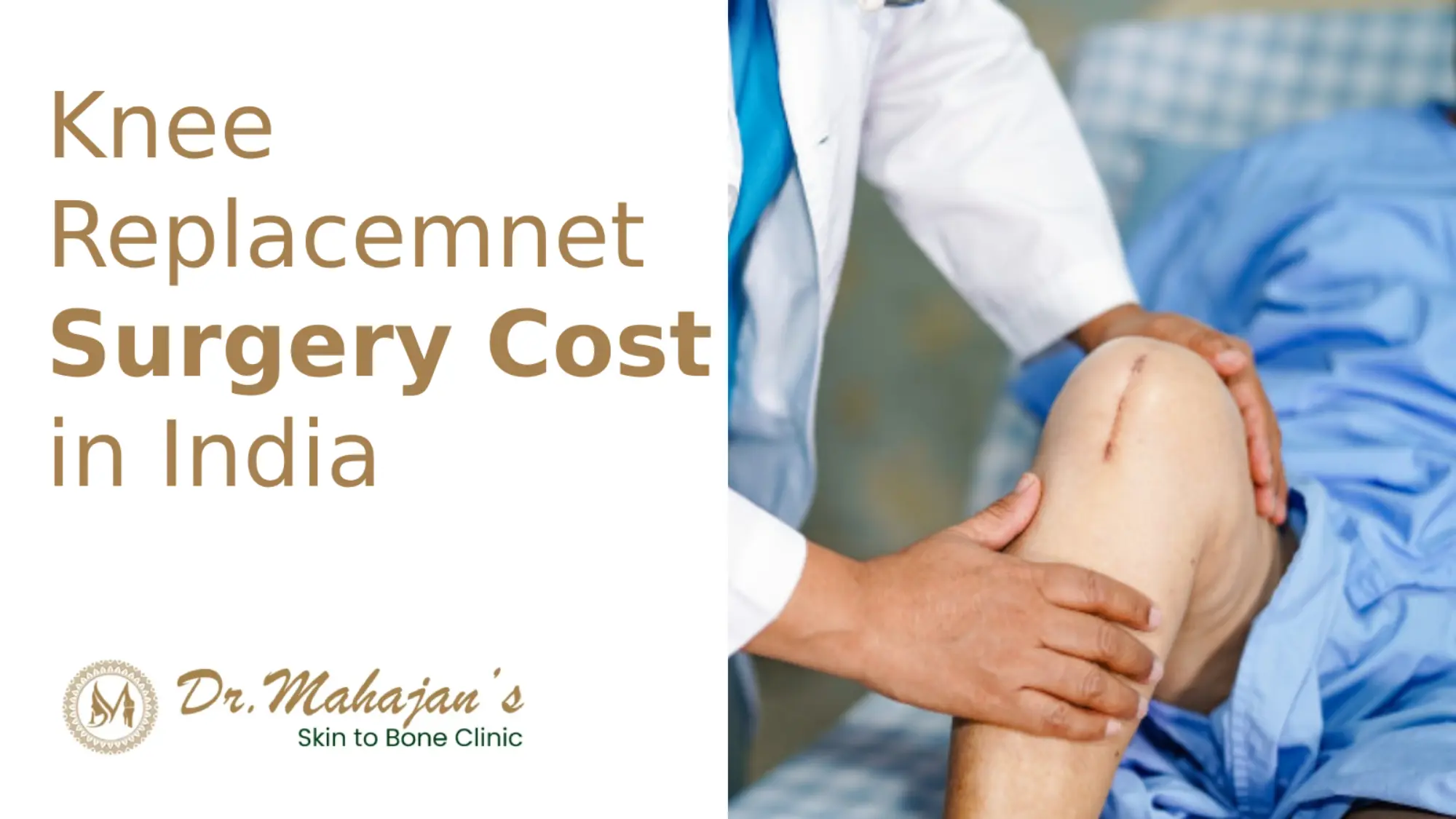 Knee Replacement Cost in India: Complete Pricing Guide for 2025